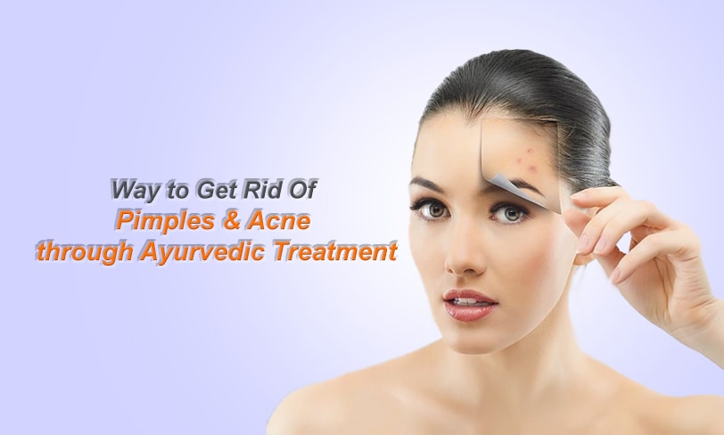 Pimples & Acne Ath Ayurdhamah