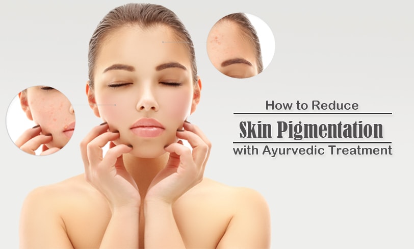 Skin Pigmentation Ath Ayurdhamah