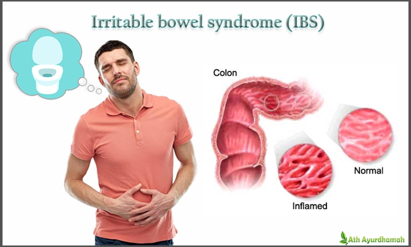 treating-ibs-with-ayurveda treating-ibs-with-ayurveda