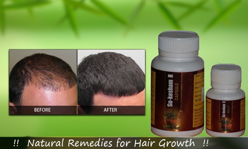 Hair Fall herbs-to-reduce-hair-fall